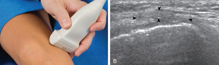 무릎 안쪽 검사