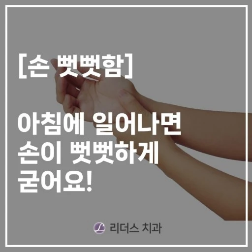 손 뻣뻣함, 이유는? / 출처 - 네이버블로그[대신동 리더스치과 이주민의 VIEW]