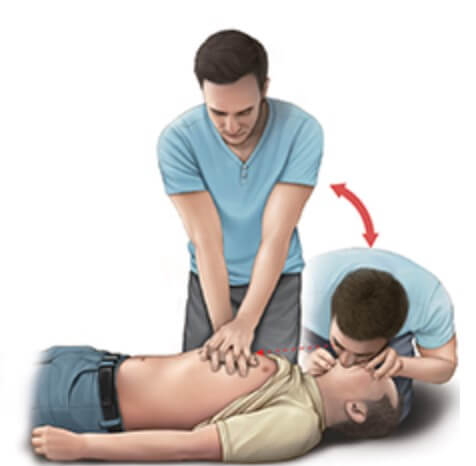 가슴압박과 인공호흡 반복