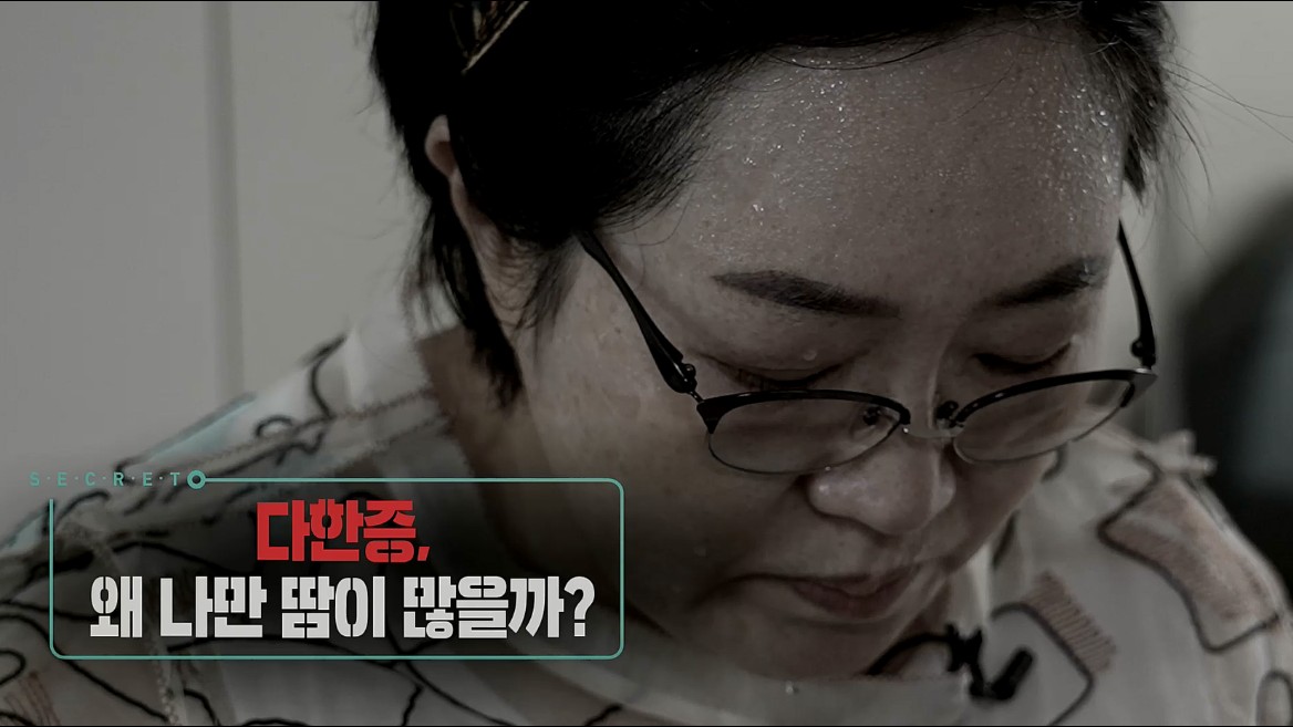 다한증