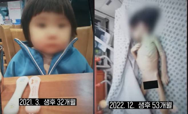 ‘위기아동 조기경보 시스템’ 도입. 실행력 부족과 예산 부족