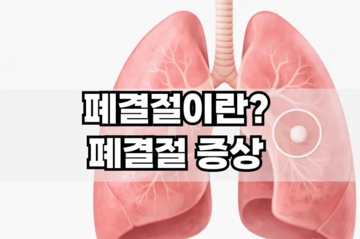폐결절이란 폐결절 증상