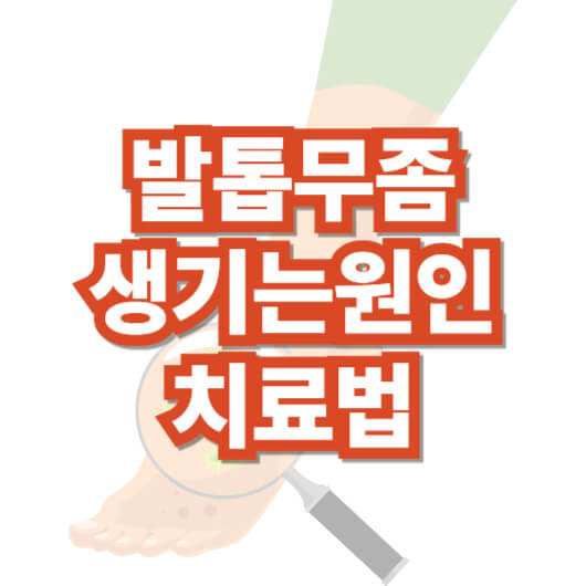 발톱-무좀-증상-생기는-원인-치료