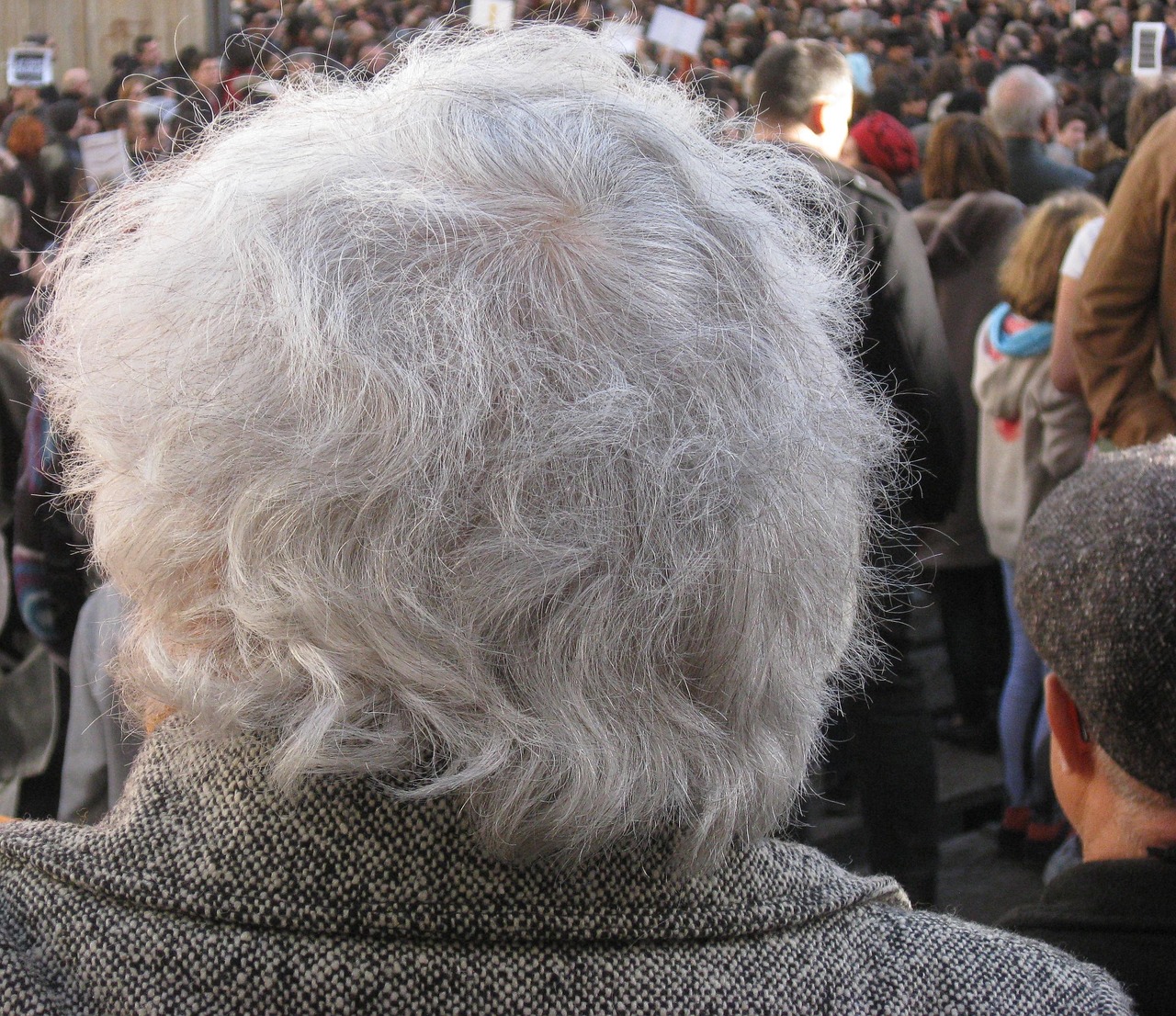 흰머리 나는 이유와 해결법