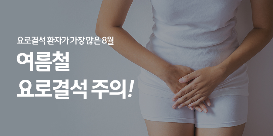 요로결석 환자 가장 많은 8월의 요로결석 주의사항