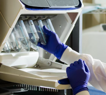 빈혈 치료방법 진단기준 합병증