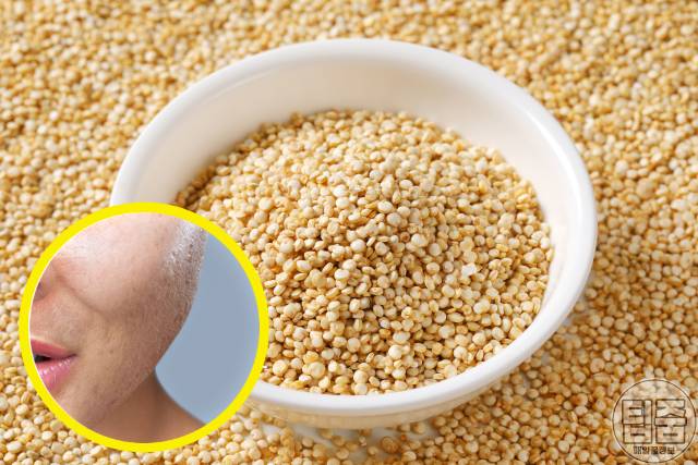 여드름흉터 치료 여드름흉터 없애는법 자연치유