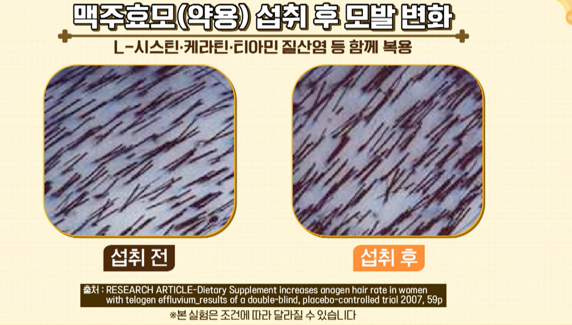 맥주 효모의 효능