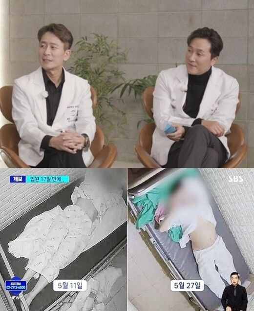 양재웅 환자 사망 하니 양재진