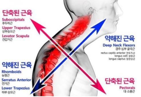1.라운드 숄더