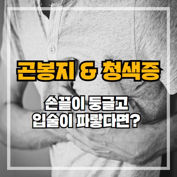 곤봉지와 청색증, 우리 몸이 보내는 심장 위험 경고