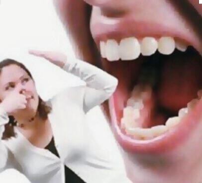 입냄새 심한 이유1