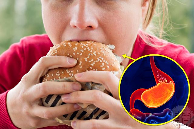 위가 부은 느낌 위가 붓는 이유 과식 폭식