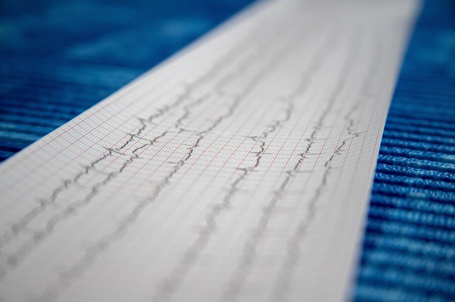 병원 의료기기를 활용한 데이터