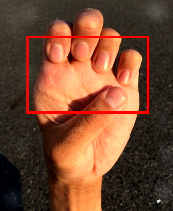 손톱 건강 확인 모습