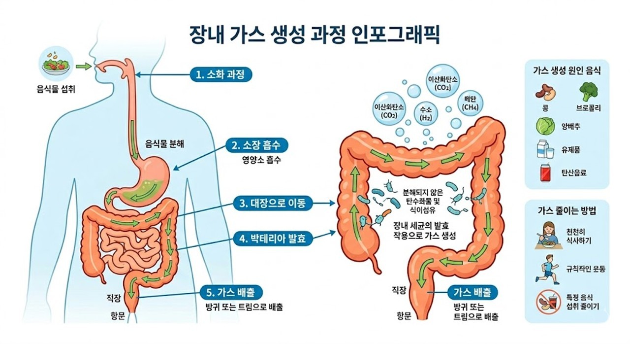 과잉 장내 가스 원인과 해결법