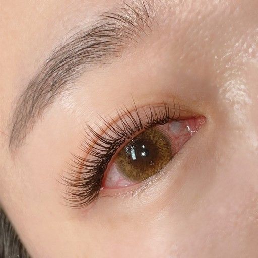 눈이 충혈되는 이유