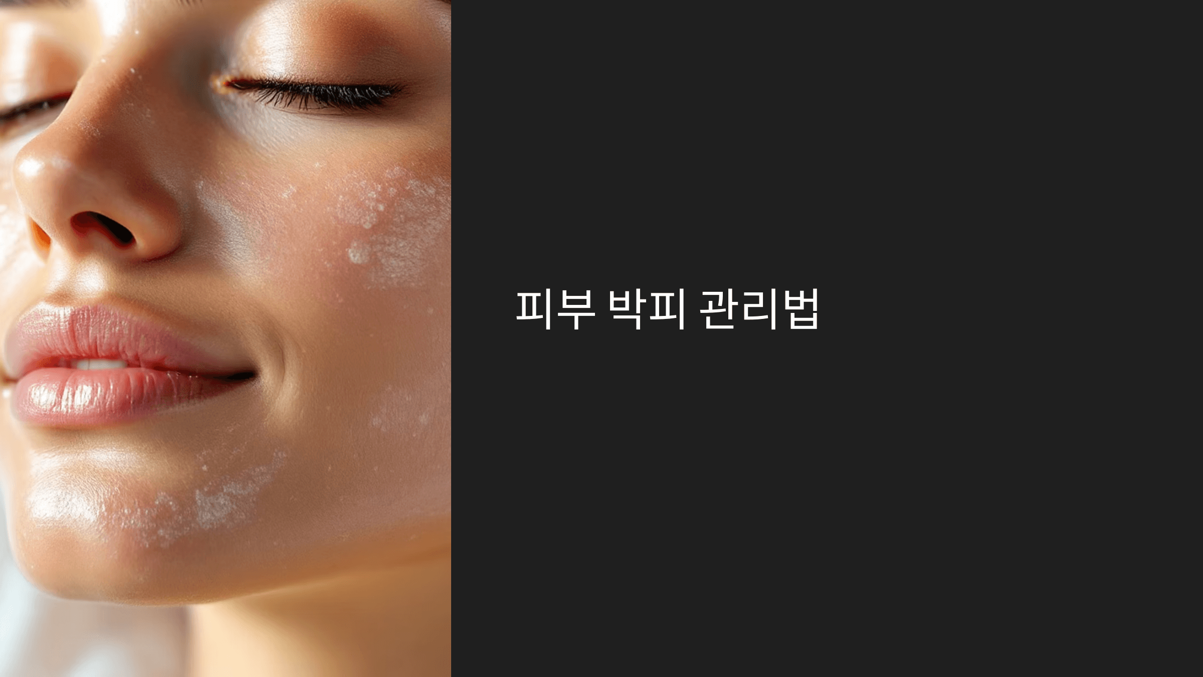 피부 박피 관리법