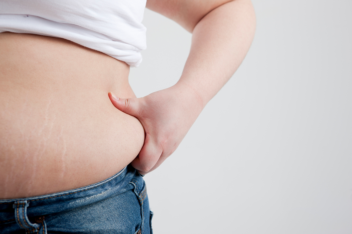 허리통증 - 복부비만