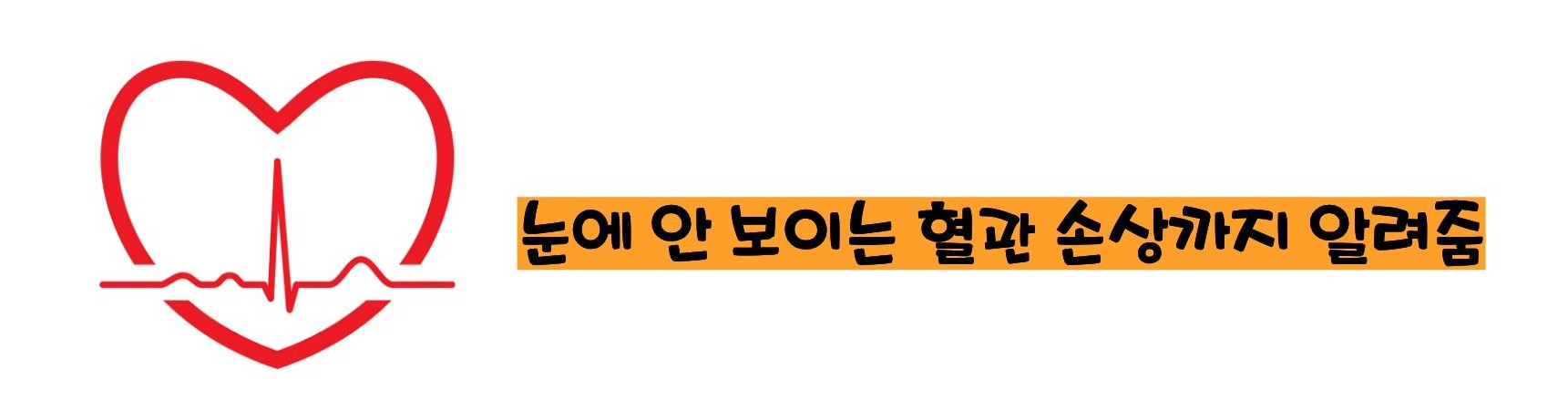 경동맥 초음파 검사로 알수 있는병의 설명