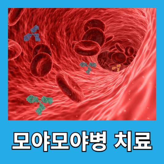 모야모야병 치료방법