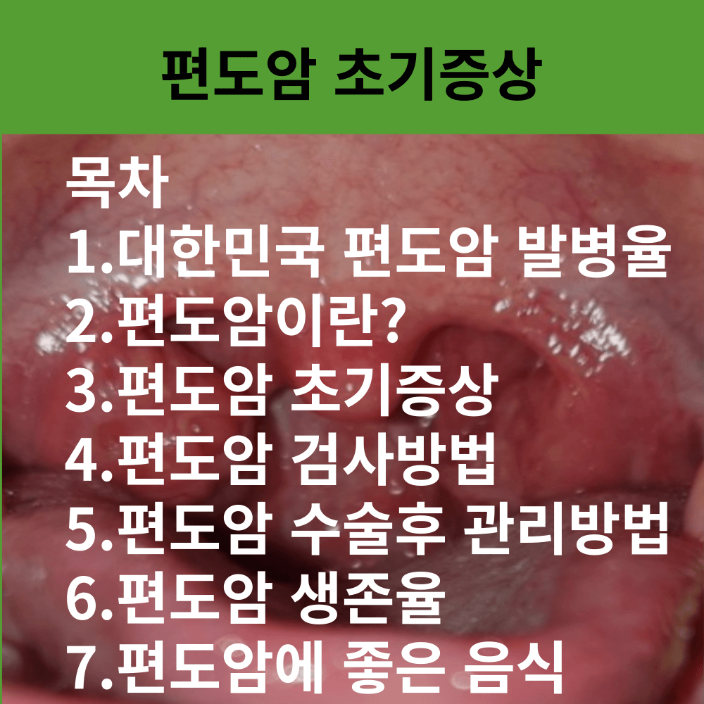 편도암 초기증상 생존율