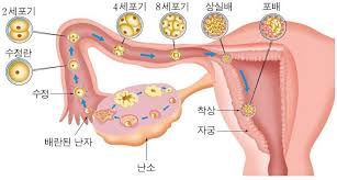 여성질환: 불임증- 자가진단, 원인, 증상, 치료방법.