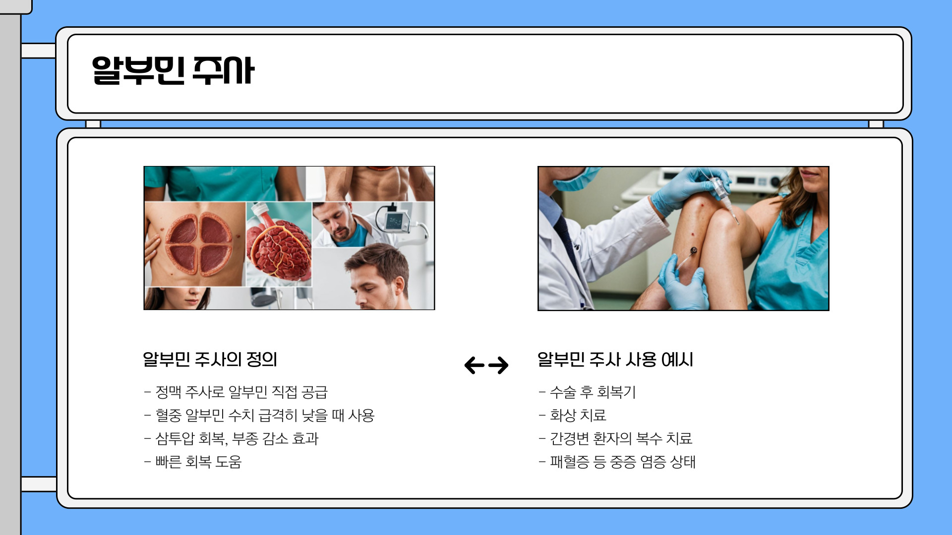 알부민