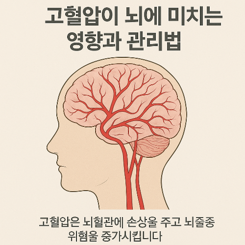 고혈압이 뇌혈관에 미치는 영향