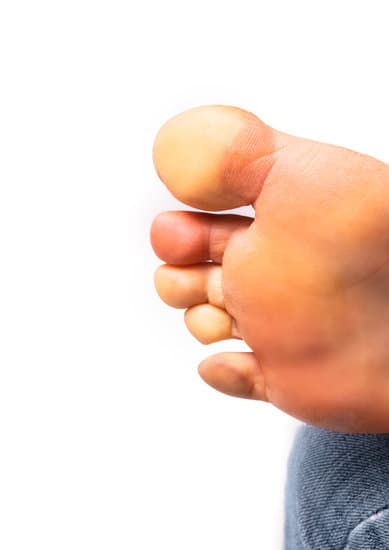 레이노병 (Raynaud's Disease): 원인, 증상, 치료 및 관리