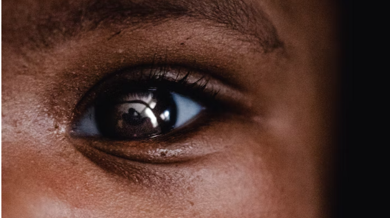 소아사시 빠른 치료로 눈 건강을 지켜요