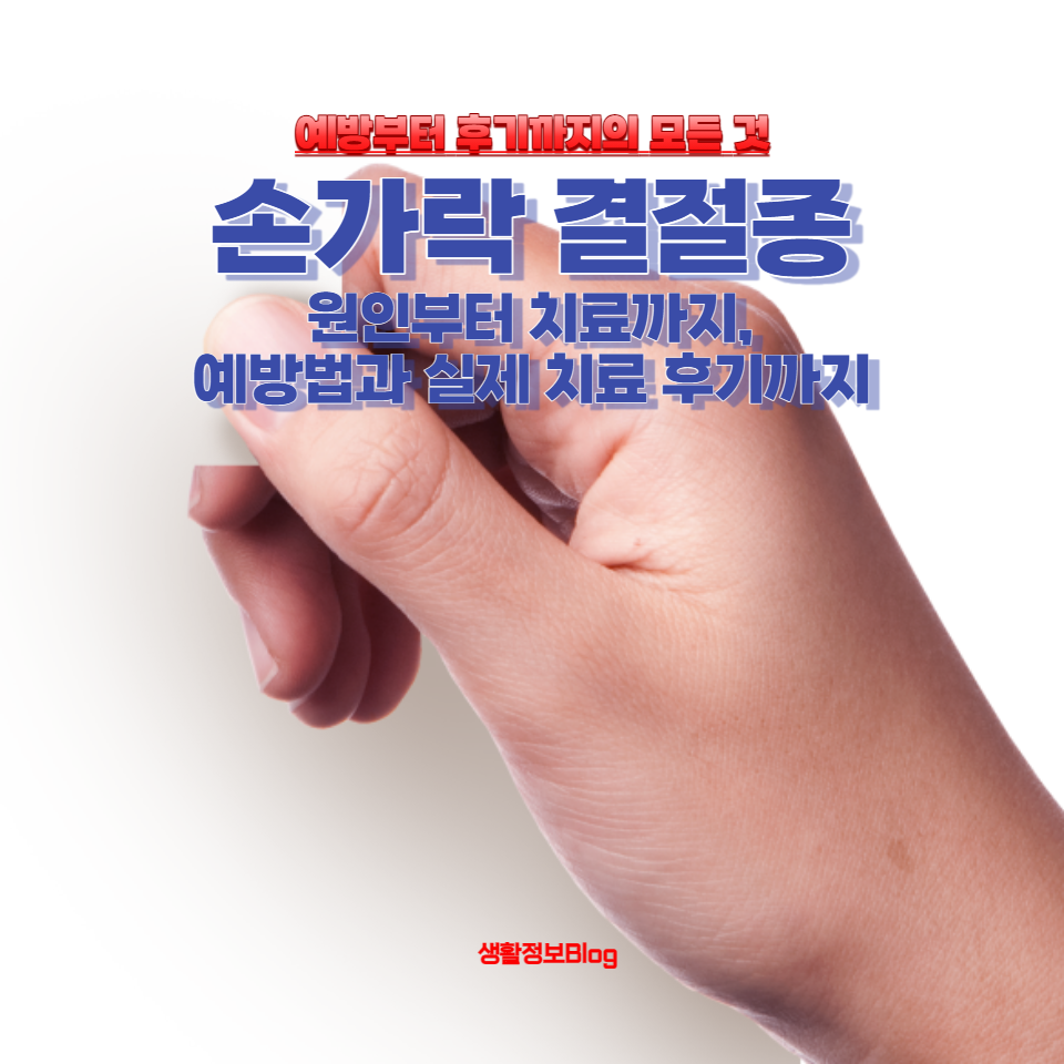 손가락 결절종의 모든 것을 알아보세요.