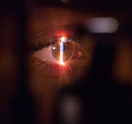 백내장 치료방법 진단 기준 예방법