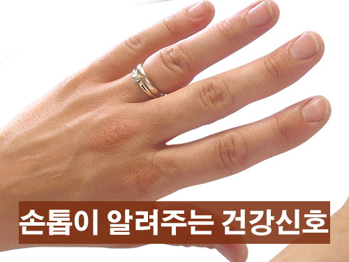 손톱 변화로 알 수 있는 건강 상태 9가지