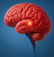 뇌출혈 전조증상