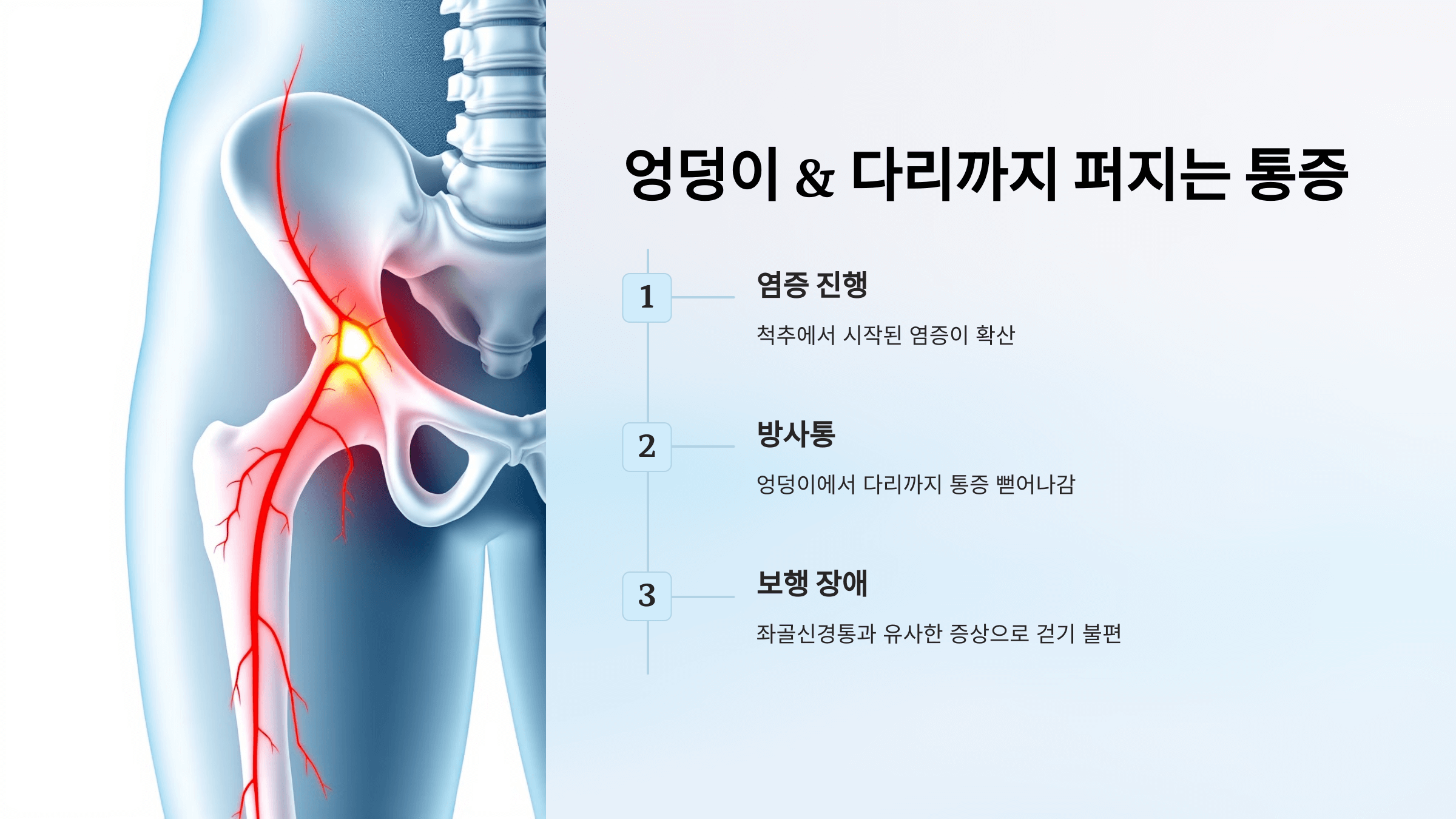 강직성 척추염과 관련된 사진입니다.