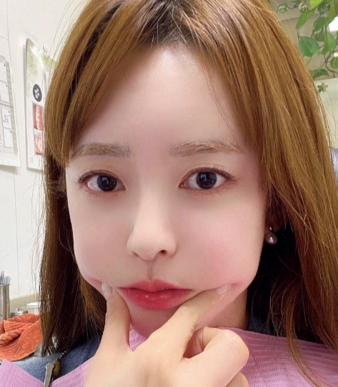 유소영 프로필 나이 고향 학력 경력 인스타 &amp;#124; 애프터스쿨 유소영 발바닥 염증 수슬 근황