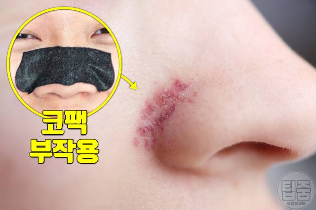 코팩 후 관리 코팩 모공 넓어짐 부작용 코팩주기