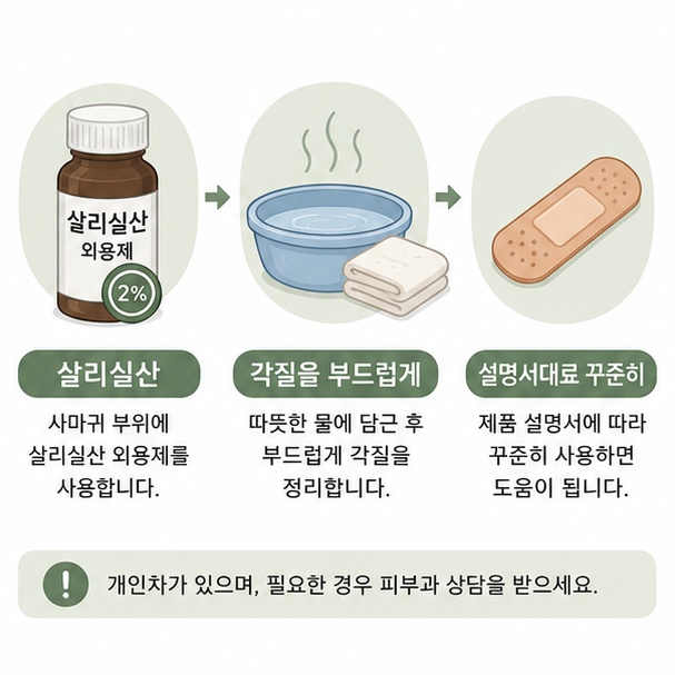 일반적인 손발 사마귀에 살리실산 성분 외용제를 설명서에 따라 사용하는 과정을 보여주는 그림