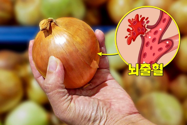 뇌혈관에 좋은 음식 양파 껍질 효능 뇌출혈 혈전에 좋은 음식 생로병사의비밀, 건강 팁줌 매일꿀정보
