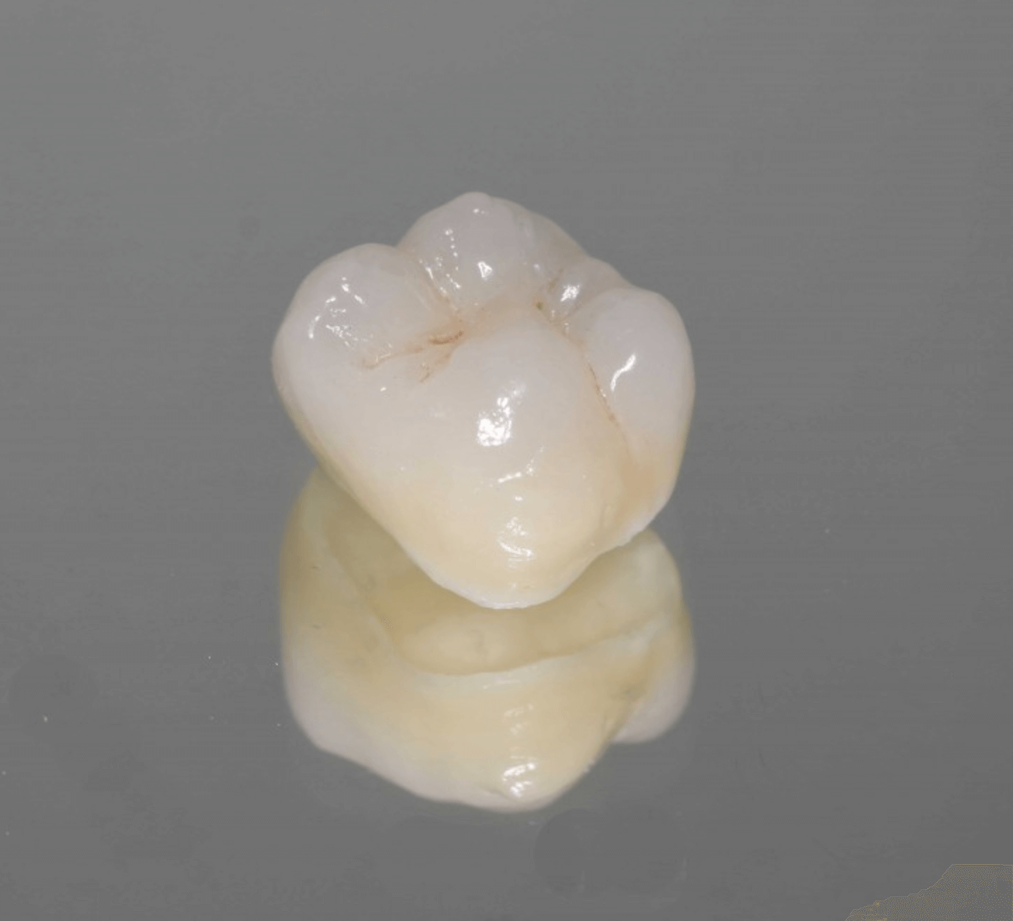 지르코니아 크라운