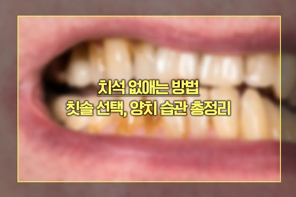 치석 없애는 방법