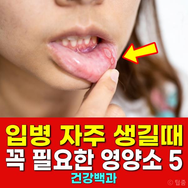 입병에 좋은 영양제 음식