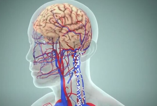 알츠하이머&middot;파킨슨&middot;혈관성 치매 차이점 총정리 + 증상 체크리스트
