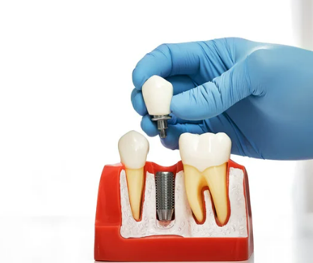 65세이상 노인 의료혜택