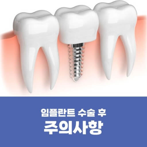 임플란트 보험 임플란트 가격 임플란트 비용 치아 보험 추천 치과 보험 추천 임플란트 치아 보험 치아 보험 적용 기과 보험 적용 치과 보험 임플란트 임플란트 치아