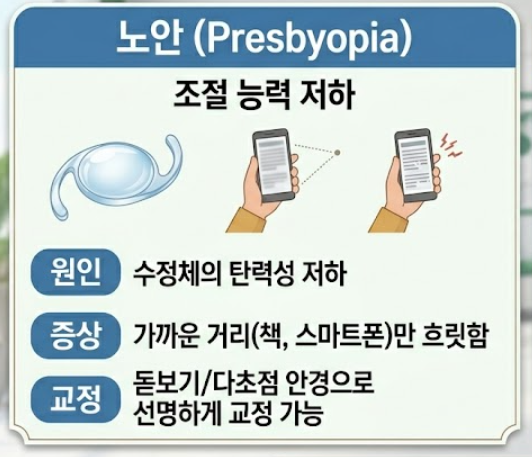 백내장 증상