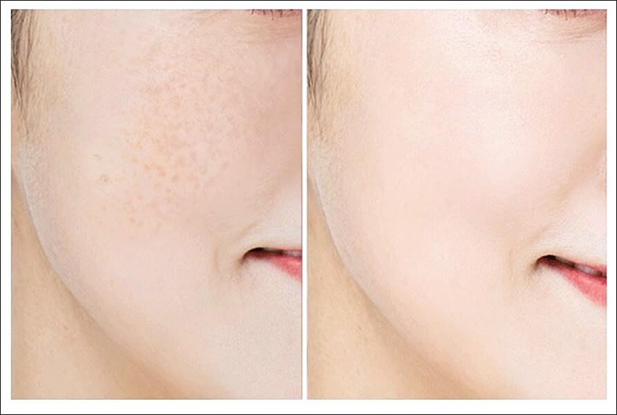 화려화 가격 및 효과 (강성연 이너뷰티)