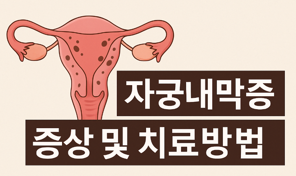 자궁내막증 증상관련 이미지