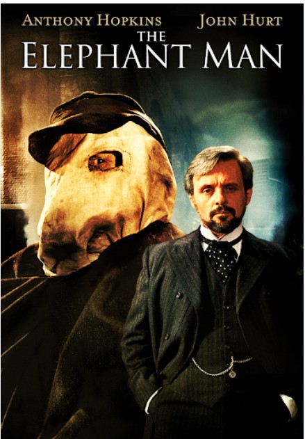 영화 <The Elephant Man> 속 인간의 심장, 존재의 고독, 잔혹한 연민